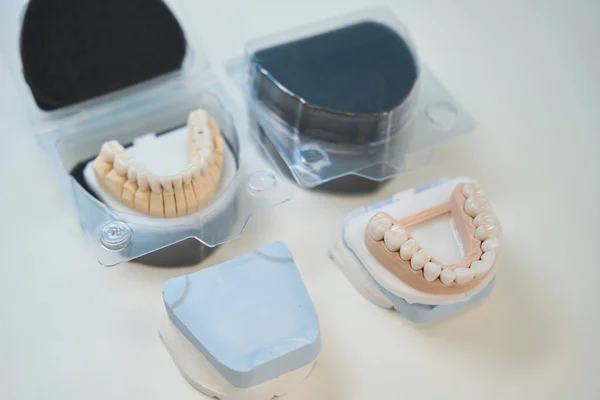 下歯と上歯の2つの大人のヒト歯科モデルのクローズアップ — ストック写真