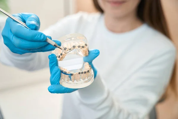 Tandarts Hygiënist Houdt Model Van Tandheelkunde Met Beugels Zijn Handen — Stockfoto