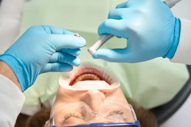 Stomatolojistlerin elleri nitril eldivenler içinde. Naylon kılları cilalayan fırçayı müşterinin diş fırçasına takıyorlar.