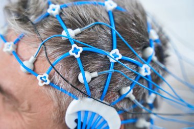 Gray-haired man on the diagnosis of EEG - electroencephalography, sensors are attached to his head