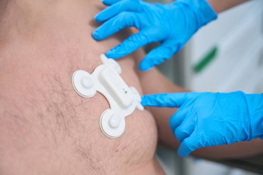 Hospital worker glues an electrode to the chest of a bare-chested patient for diagnostic ECG - electrocardiography