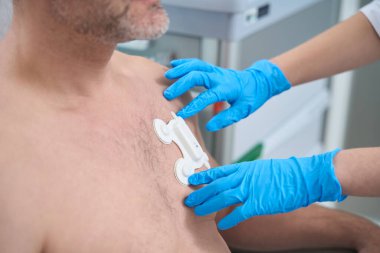 Paramedic glues an electrode to the chest of a patient with a naked torso, for diagnostic ECG - electrocardiography