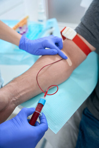 Nurse takes a blood sample from a vein from a patient in a medical clinic, she works in protective gloves
