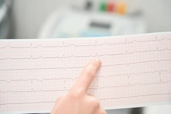 Close Picture Detail Result Heartbeat Examining Medicine Center — ストック写真