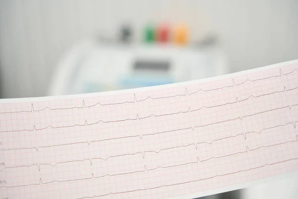 Close up picture of electrocardiogram by heartbeat in the medicine center