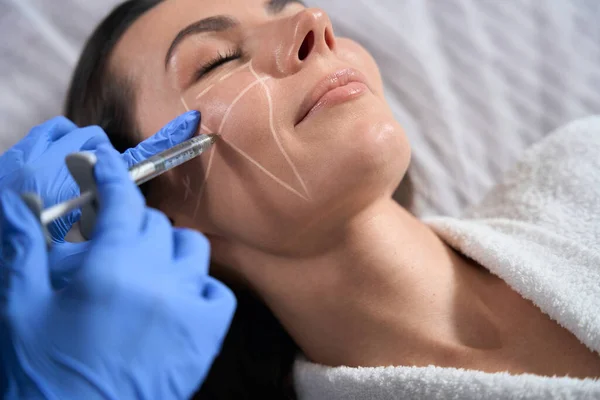 Kosmetologe Schutzhandschuhen Hält Spritze Und Macht Schönheitsinjektionen Für Gesicht Dame — Stockfoto