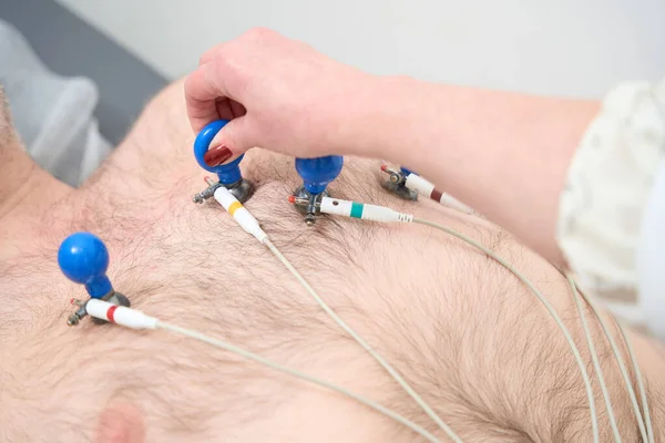 Female Nurse Sticking Vacuum Electrodes Patient Chest Electrocardiogram Heart Pulse — Stock Photo, Image