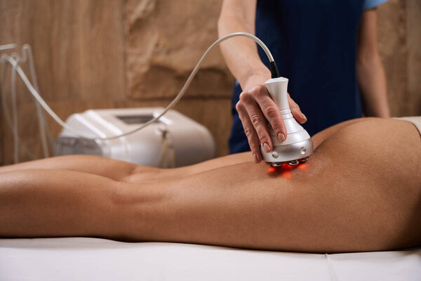 Женщина-специалист, выполняющая процедуру РФ по поднятию ягодиц и бедер у женщины в спа-салоне