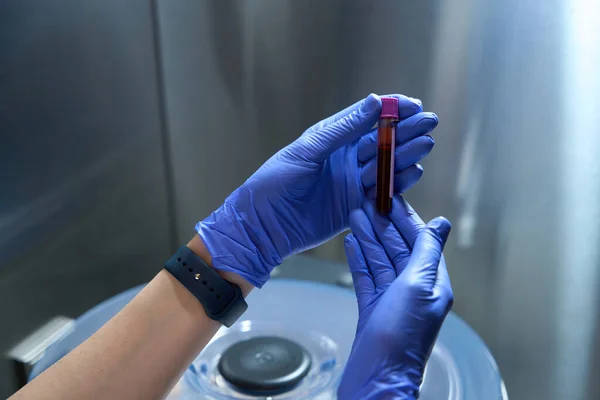 Pracownik Służby Zdrowia Rękawiczkach Lateksowych Trzyma Probówkę Krwią Środku — Zdjęcie stockowe