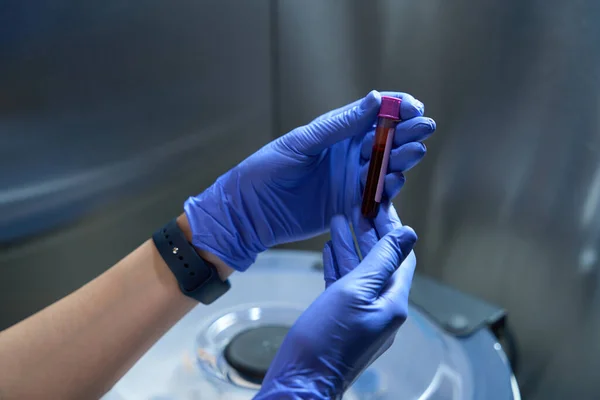 Przycięte Zdjęcie Pracownika Służby Zdrowia Rękawiczkach Lateksowych Trzyma Probówkę Krwią — Zdjęcie stockowe