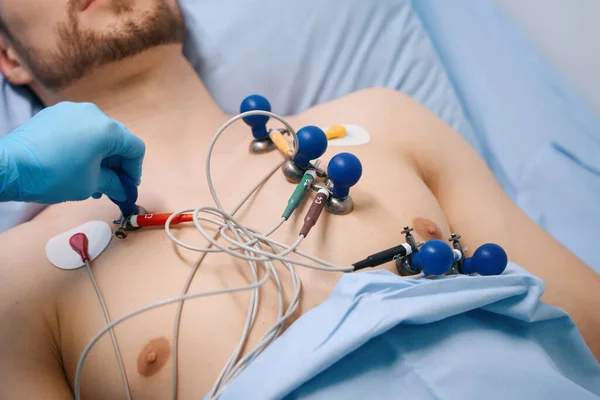 Cardiograph suction cups are attached to a young patient, a man lies on a hospital bed with a naked torso
