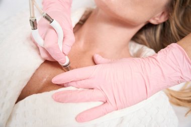 Hasta yenilikçi bir lazer yüzey prosedüründen geçiyor. Uzman, CO2 lazer kullanıyor.