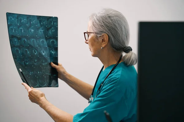Досвідчена Жінка Діагностик Вивчає Мрт Сканування Мозку Лікар Медичній Формі — стокове фото