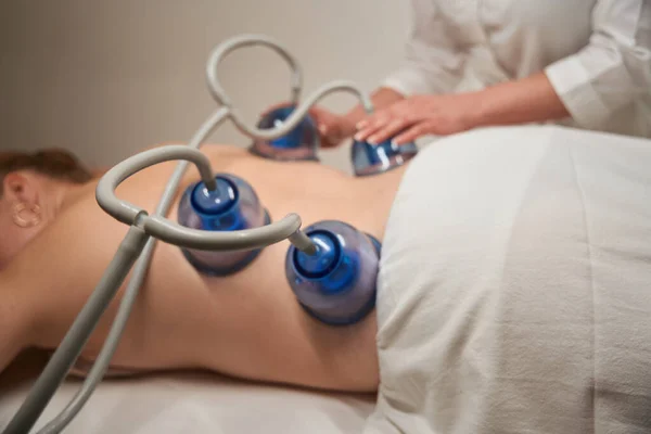 Massaggiatore Clinica Attacca Ventose Clienti Schiena Nuda Procedura Terapia Del — Foto Stock