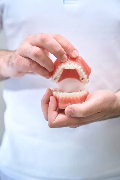 歯科医は 顎のモデルに歯科用アライナーを示しています 彼らは環境に優しい材料で作られています — ストック写真