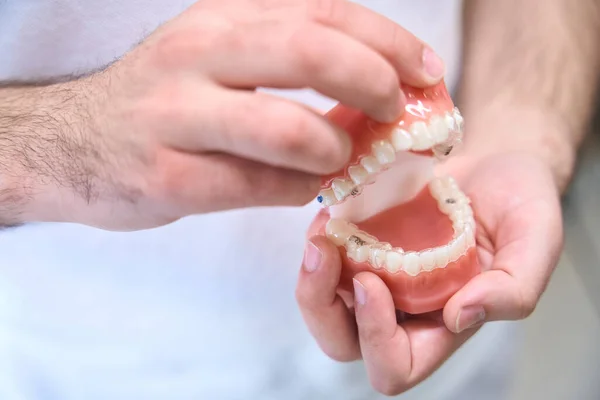 Doctor Demonstrates Sample Dental Aligners Model Jaws Made Environmentally Friendly — Stock Photo, Image