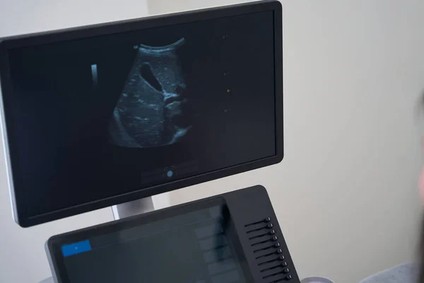 Monitor Máquina Ultra Som Com Imagem Dos Órgãos Internos Este — Fotografia de Stock