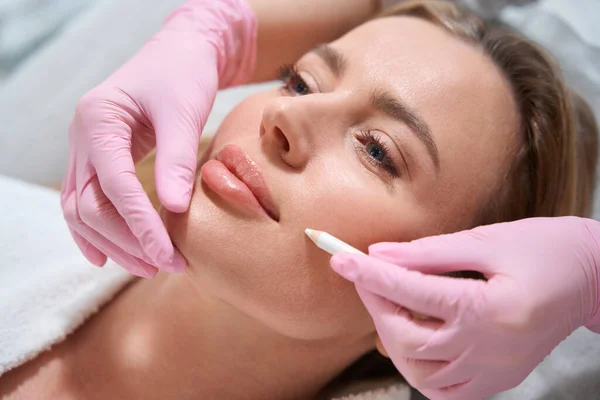 Mujer Rubia Una Consulta Una Clínica Cosmetología Especialista Utiliza Marcador — Foto de Stock
