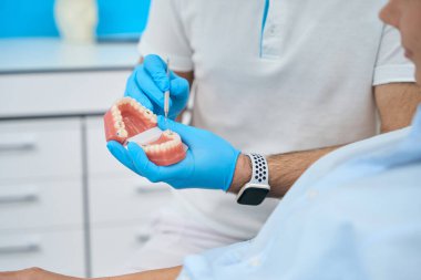 Ortodontist, anatomik diş modelini tutuyor ve orak sondasıyla kadın hastaya tedavi yöntemlerini veya diş tellerini, protezlerini, estetik dişlerini gösteriyor.