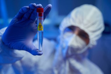Koruyucu eldivenlerdeki laboratuvar asistanı elinde biyomateryalle test tüpü tutuyor. Test tüpünde tehlikenin sembolü var.