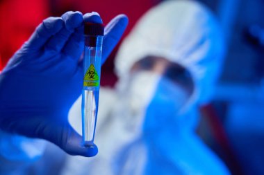 Koruyucu eldivenli bir adam elinde biyomateryalle test tüpü tutuyor. Test tüpünde tehlikenin sembolü var.