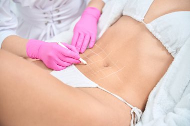 Profesyonel kuaförde güzellik prosedüründen önce beyaz kalem tutan kozmetolog ve göbeğinde işaretleme bölgeleri