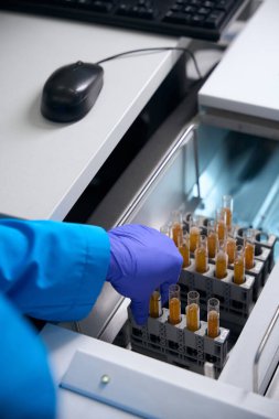 Sağlık çalışanı elinde idrar testi için biyomateryal içeren test tüpleri tutuyor. Koruyucu eldiven giyen bir adam.