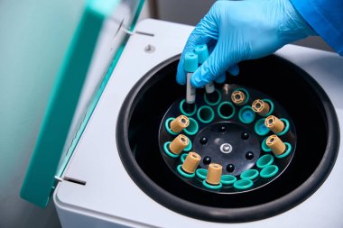 Laboratuvar çalışanı, biyomateryalli test tüplerini özel bir alete yerleştirir.