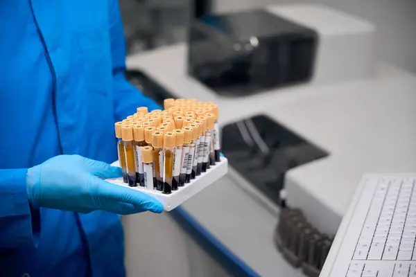 Researcher Holds His Hands Set Test Tubes Blood Samples Tests — Stock Photo, Image