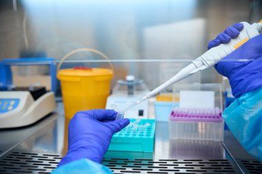 Bulaşıcı hastalıklar uzmanı, laboratuvar pipet dağıtıcısı kullanıyor. Masanın üzerinde biyomateryal olan sarı bir kap var.