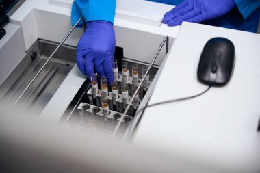 Laboratuvar genel idrar analizi için biyomateryal içeren test tüpleriyle kuruldu. Laboratuvar asistanı koruyucu eldivenler üzerinde çalışıyor.