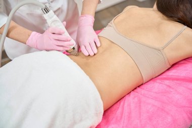 Güzellik uzmanı sırtının sol tarafına mikronedle radyo frekansı el yazısını bastırırken hastanın kanepede yatarken çekilmiş fotoğrafı.