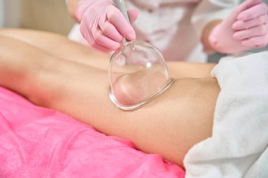 Nitrile eldivenli güzellik terapistinin vakum tüpünü hastanın kalçasının arkasına yerleştirirken çekilmiş fotoğrafı.