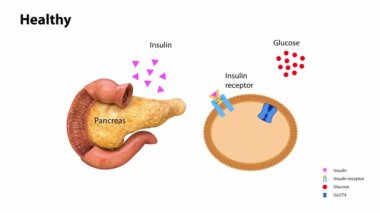 İnsülin etkisi ve diyabet türü 1 ve 2, 2d animasyon, canlandırma, metabolik hastalıklar, pankreas hastalıkları, insülin reseptörleri, pankreas