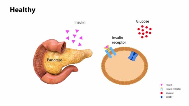 インスリン作用および糖尿病のタイプ1 3Dアニメーション レンダリング 代謝病 膵臓病 インスリン受容体 — ストック動画