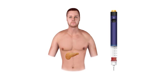 男性の3D図 腹にインスリンペンで注射する糖尿病の男性 タイプ1とタイプ2糖尿病 3Dアニメーション — ストック動画