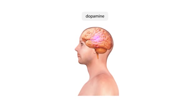 Ілюстрація Людської Голови Вертіго Типів Залежності Діагностики Ігри Паління Наркотики — стокове відео