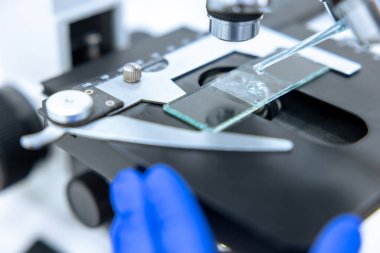 Bilimsel ya da tıbbi test örneği mikroskop altında laboratuvarda, yakın planda, bilim adamı mikroorganizmaları inceler..