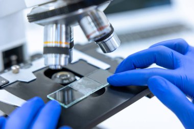 Mikroskobik endoskopi yapan araştırmacılar hücrelerin bozulmasını, laboratuvar deneylerini ve test camlarıyla çalışan bilim adamlarını inceliyorlar..