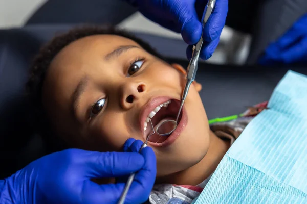 Odontología Dentista Tratar Los Dientes Los Niños Piel Oscura —  Fotos de Stock