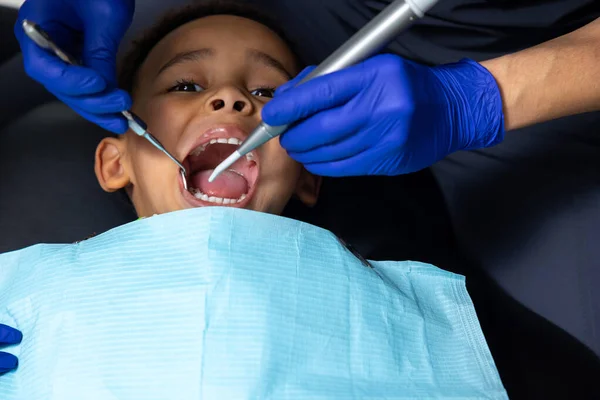 Zubaře Kluk Tmavou Pletí Sezení Zubním Lékařství — Stock fotografie