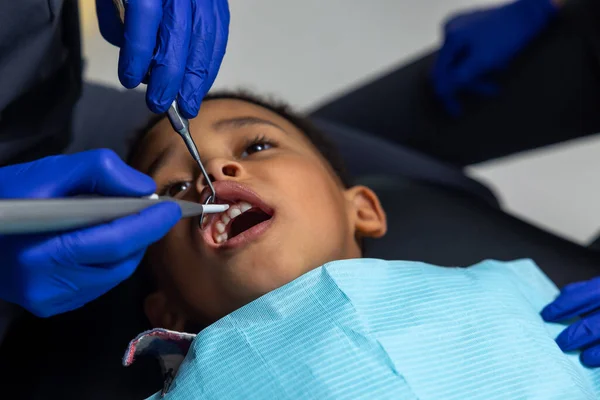 Odontología Niño Piel Oscura Que Parece Asustado Las Herramientas Médicas —  Fotos de Stock