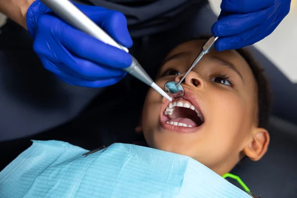 Odontologia Rapaz Pele Escura Com Medo Ferramentas Médicas — Fotografia de Stock