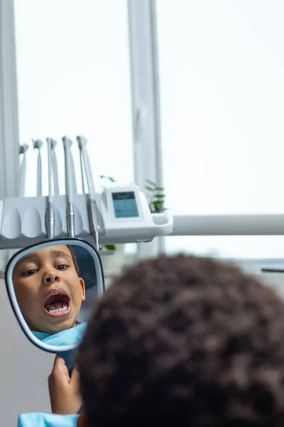 Zubaře Chlapec Tmavou Pletí Dívá Své Zuby Zrcadle — Stock fotografie