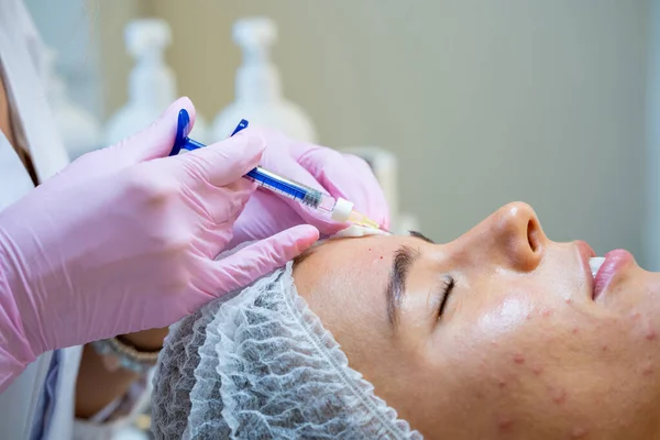 年轻女性皮肤美容术治疗及临床女性患者专业注射 — 图库照片
