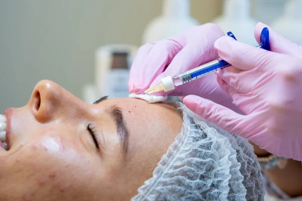 Ansiktsinjektioner Till Kvinnor Med Hudproblem Skönhetsbehandling Kosmetologiska Kliniken Prp Ttherapy — Stockfoto