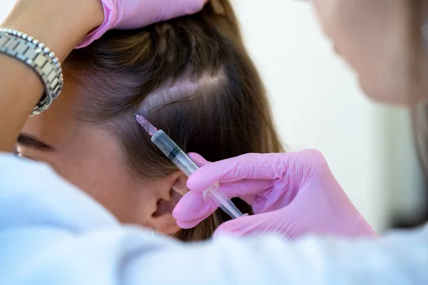 Profesjonalne Leczenie Wypadania Włosów Nierozpoznawalna Głowa Kobiety Ręce Lekarzy Strzykawką — Zdjęcie stockowe