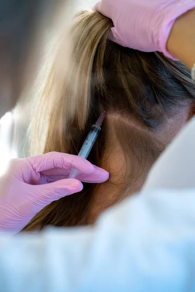 Nierozpoznawalna Profesjonalistka Wykonująca Wstrzyknięcia Strzykawką Głowę Odmładzanie Leczenie Wypadania Włosów — Zdjęcie stockowe