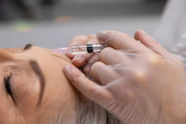 Vulinjecties Beautician Doet Filler Injecties Aan Een Volwassen Vrouwelijke Patiënt — Stockfoto