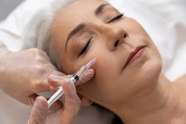 Altershemmende Verfahren Frau Mit Falten Filler Injektionen Augenbereich — Stockfoto